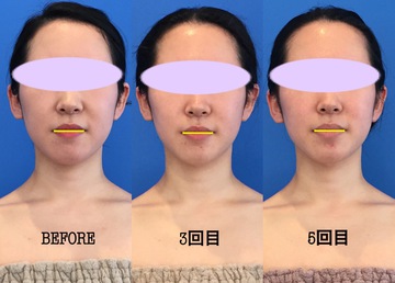 今の状態は自分史上最高ですか? 今の状態は自分史上最高ですか?