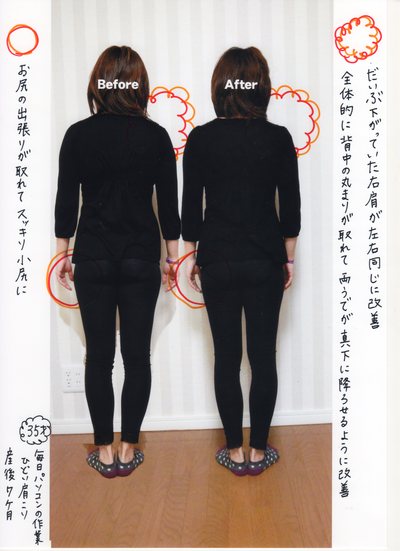 効果の写真