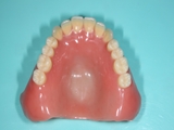 究極の入れ歯治療