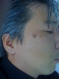 シミを取ってみました 2011/03/30 09:47:05