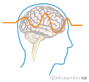 はまぞうクラウド　浜松｜新たな認証システムはなんと「脳波」
