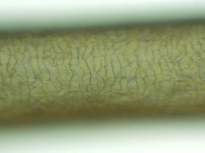 毛髪診断