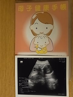久々の妊婦健診（7カ月目）♪