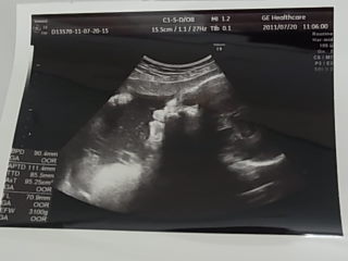 妊婦健診☆10カ月・37週目☆