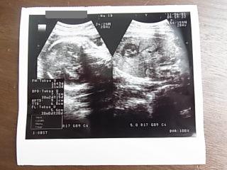 妊婦健診☆8ヶ月・30週目☆