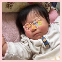 顔に傷が！ 2015/02/23 13:32:59