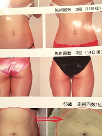 限定❗️3名様♥️