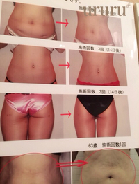 足痩せ〜❗️